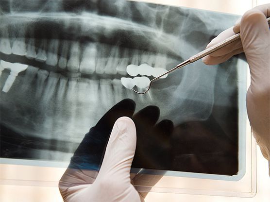 Røntgen billede på tandklinikken